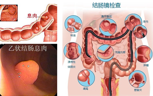萎縮性胃炎真的“很嚇人”？看完這“七個事實”你就明白了