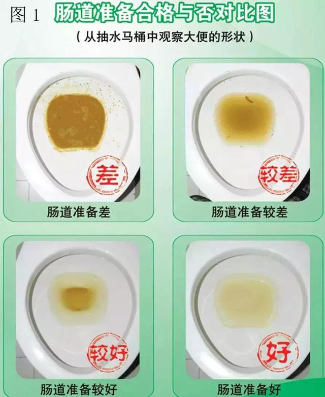 南寧潰瘍性結腸炎到哪個醫(yī)院治